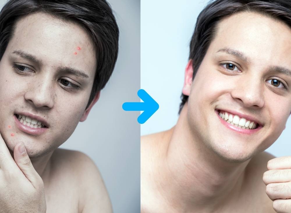 мужской уход за лицом до и после