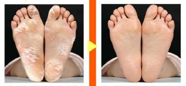Пилинг-носочки Cosme Baby Foot глубокого действия (размер S)